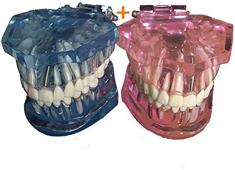 KH66ZKY 2 PCS dentes dentários de dentes removíveis Modelo de dente de dente