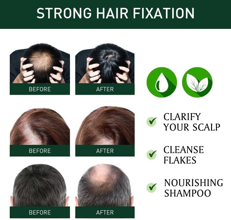 Novo 2022 Ginger Hair Grower Shampoo Scalp Scalp Tratamento Crescimento Controle