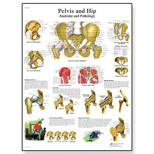 3B Scientific VR1172L Papelvis laminado brilhante e gráfico de Hip Anatomi e Patologia, Tamanho do pôster 20 Largura x 26 Altura