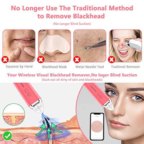 Vacuador de poro de removedor de cravo, Wi -Fi 5,0 megapixels Visible Facial Pore Cleanser com câmera HD Kit de extrator de comedona