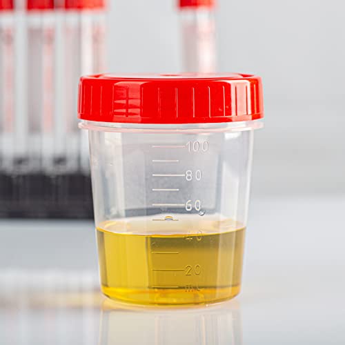 Cups de amostra de 120 ml de Patikil, 2 contêineres de amostra de embalagem Tampa de parafuso à prova de vazamento para casa