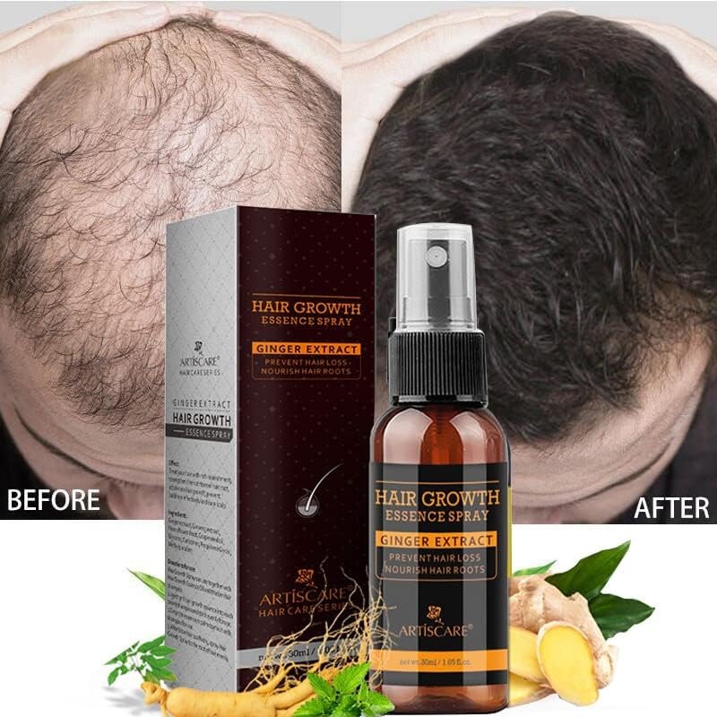 Crescimento de cabelos de gengibre Óleo Spray essencial Anti -perda de cabelo Produtos de perda de cabelo impedem tratamento